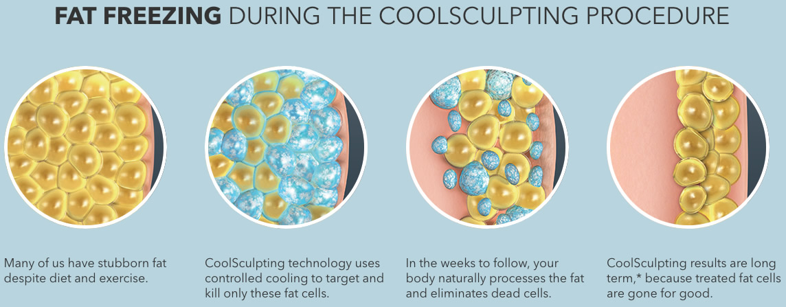 CoolSculpting How Does It Work